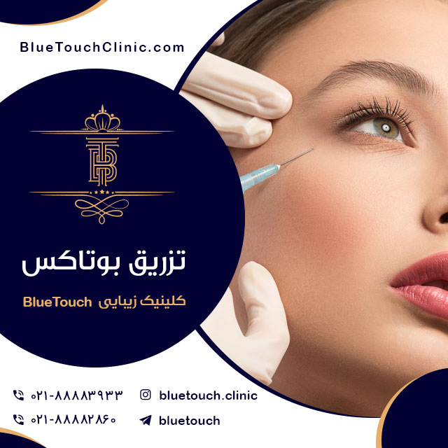تزریق بوتاکس