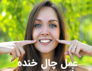 عمل چال گونه یا چال خنده