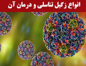 انواع زگیل تناسلی و درمان آن