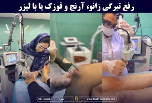 روشن سازی زانو، قوزک پا و آرنج دست با لیزر