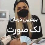 بهترین درمان لک صورت