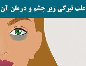 درمان تیرگی زیر چشم و رفع سیاهی دور چشم