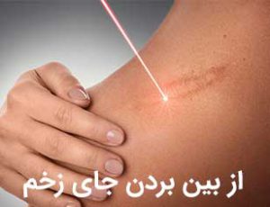 بهترین روش های از بین بردن جای زخم