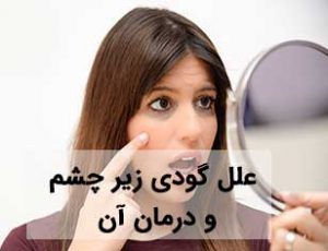 علت گودی زیر چشم چیست و چگونه درمان می شود