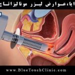 لیزر مونالیزا تاچ: عوارض، مزایا، کاربردها و هزینه ها