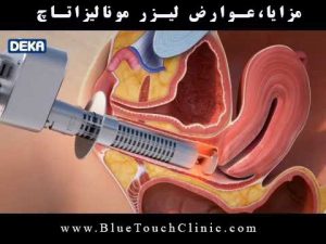 لیزر مونالیزا تاچ: عوارض، مزایا، کاربردها و هزینه ها