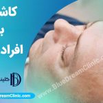 کاشت مو برای افراد دیابتی