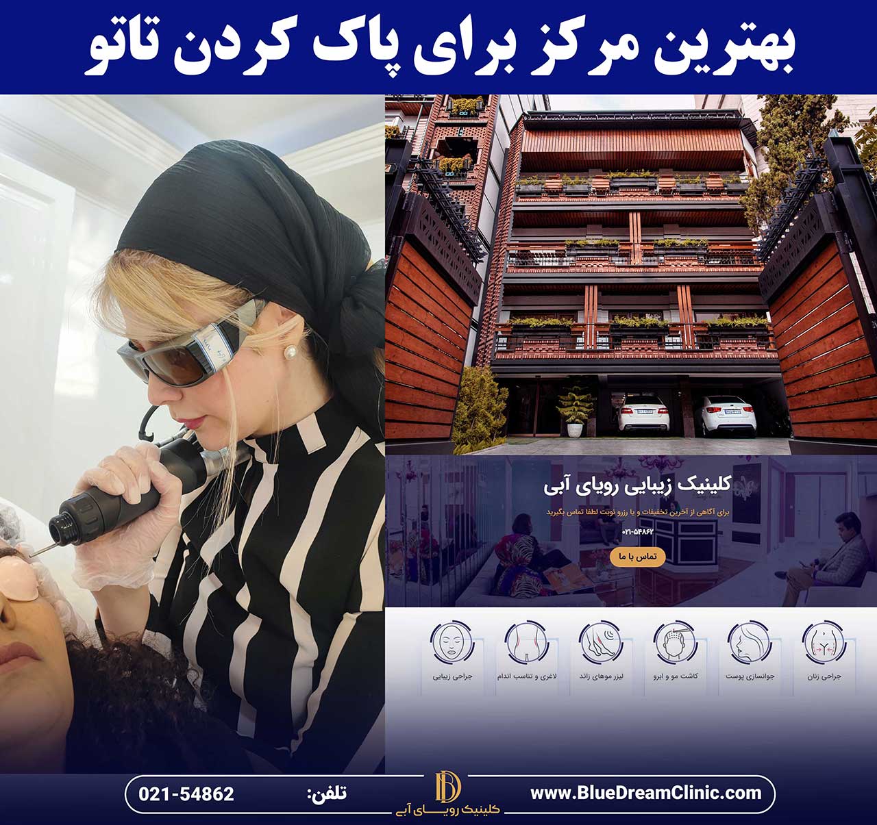 بهترین مرکز برای پاک کردن تاتو در تهران