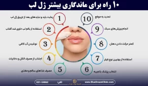 10 راه برای ماندگاری بیشتر ژل لب