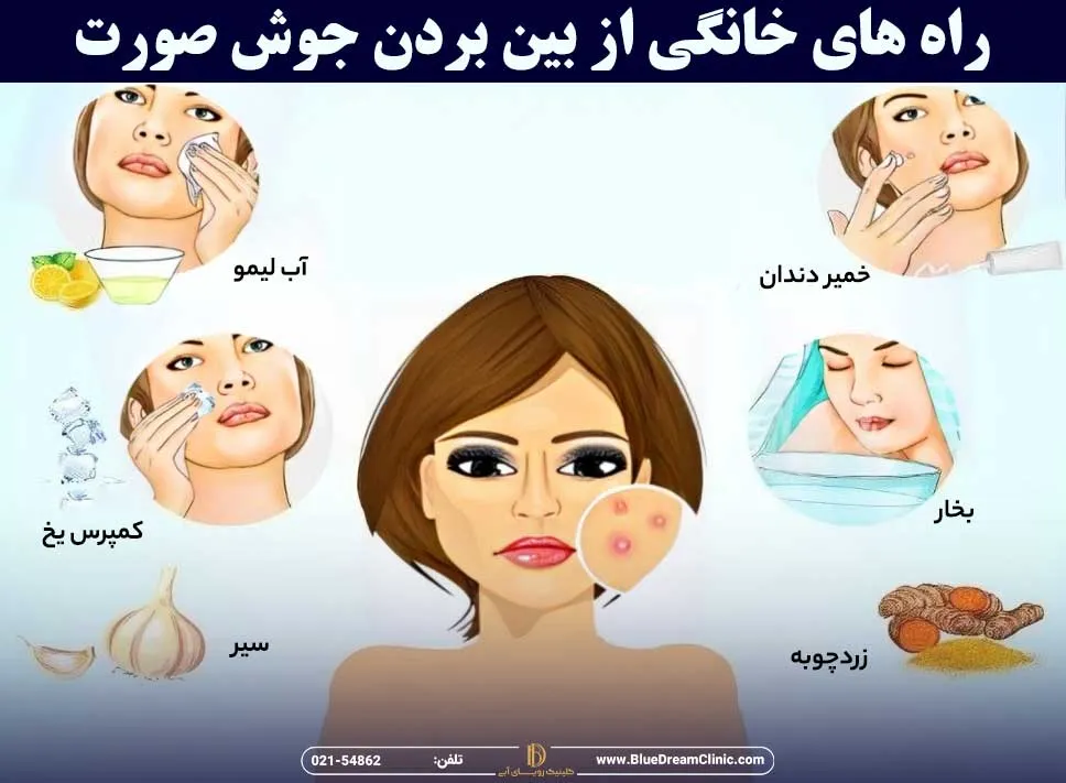 راه های خانگی از بین بردن جوش صورت