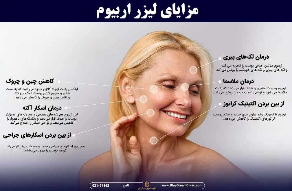 مزایای دستگاه لیزر اربیوم