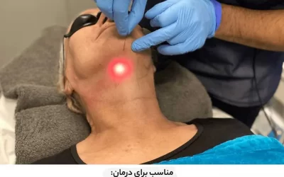 اندولیفت چیست و چه کاربردی دارد؟(مزایا و عوارض)