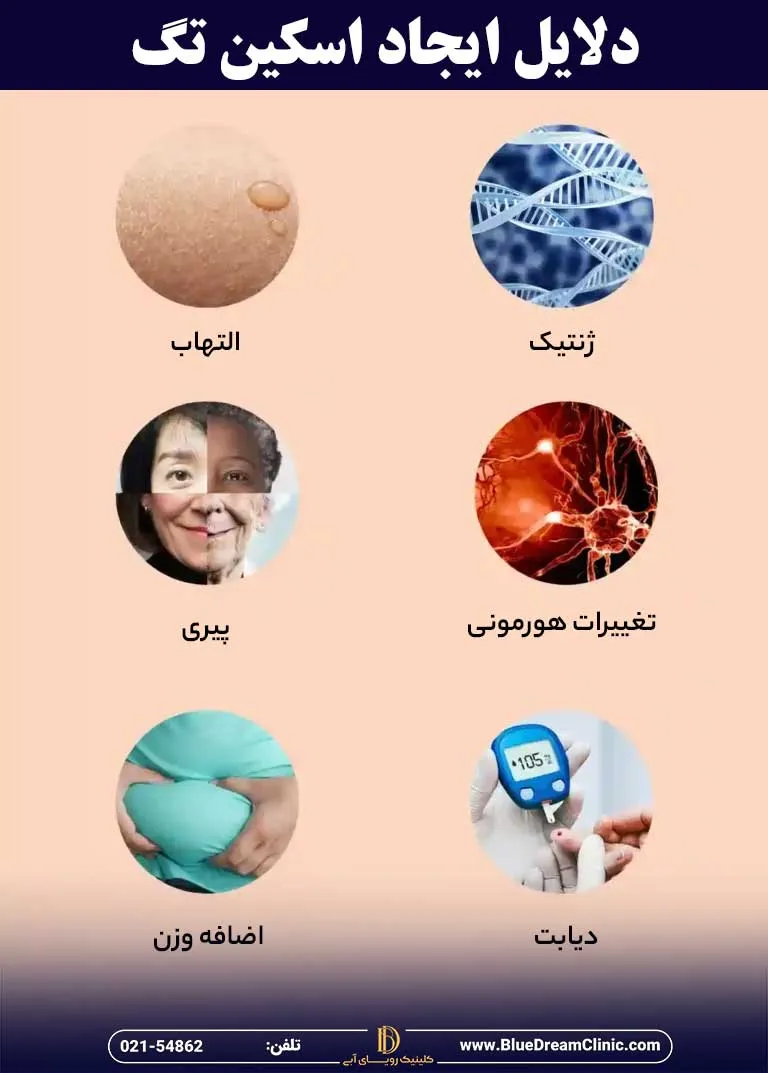 علت ایجاد اسکین تگ