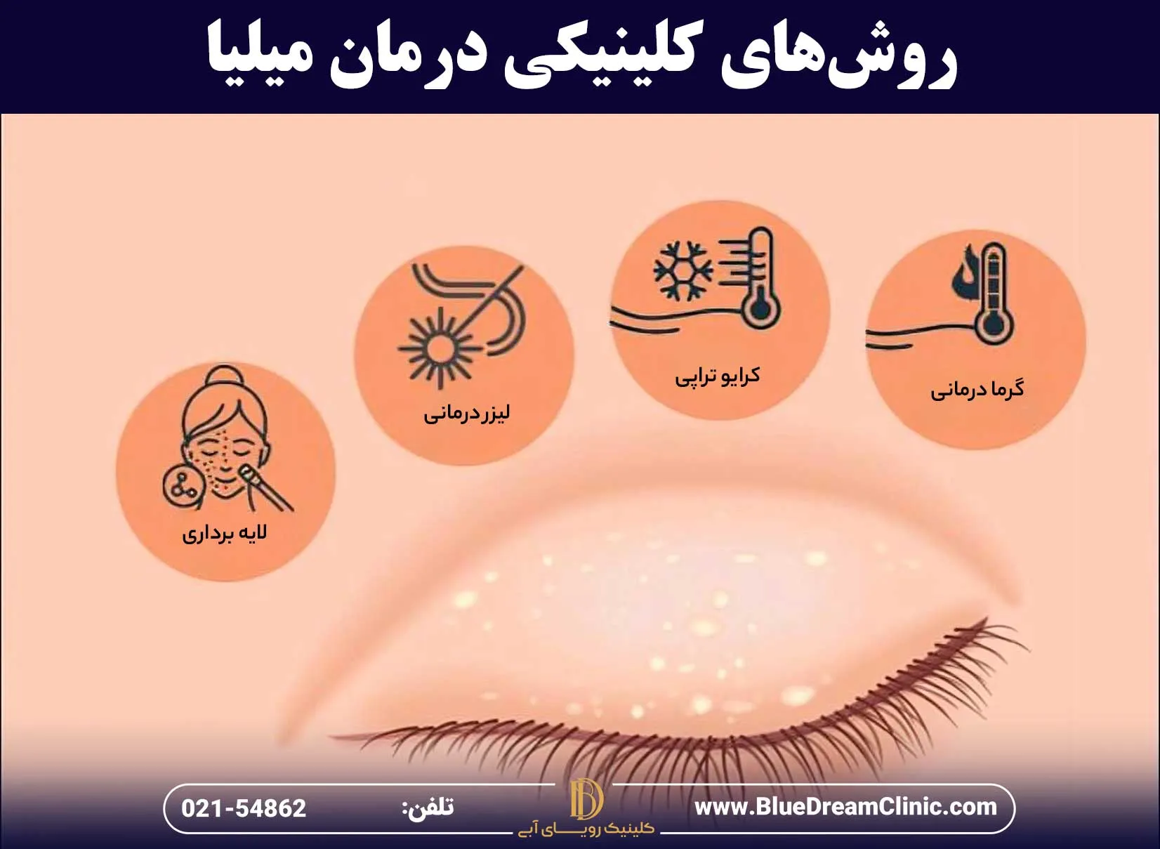 راههای از بین بردن میلیا در مطب