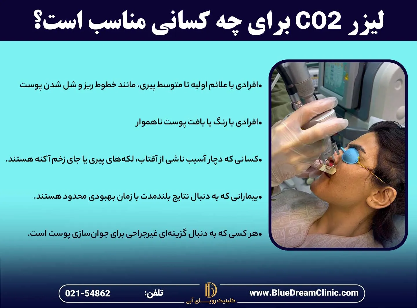 لیزر co2 برای چه افرادی مناسب است