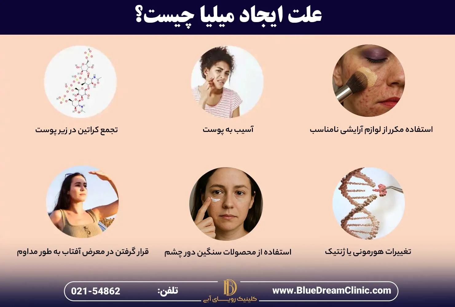 علت ایجاد میلیا زیر چشم