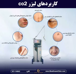 کاربردهای لیزر co2