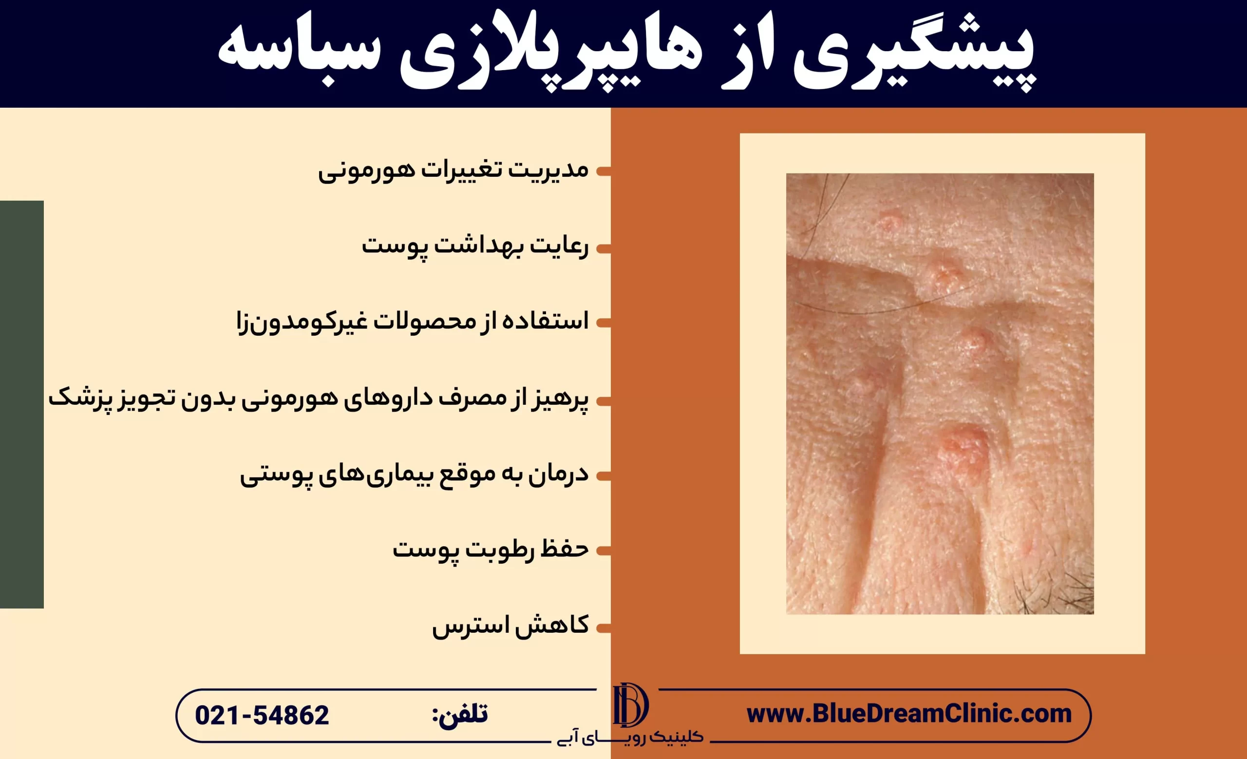 پیشگیری از هایپرپلازی