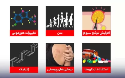 هیپرپلازی سباسه چیست و چگونه درمان می‌شود؟