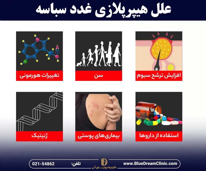 علل ایجاد هیپرپلازی سباسه