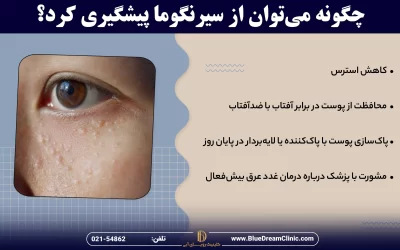 سیرنگوما چیست؟ علائم، درمان و راه‌های پیشگیری از سیرنگوما را بشناسید