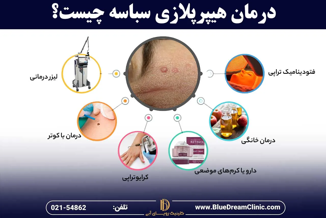 درمان هیپرپلازی سباسه